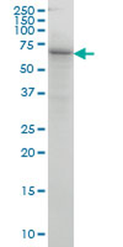 COG6 monoclonal antibody (M01), clone 5B5