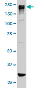 ARID1B monoclonal antibody (M01), clone 2D2