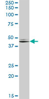 NDRG2 MaxPab mouse polyclonal antibody (B01)