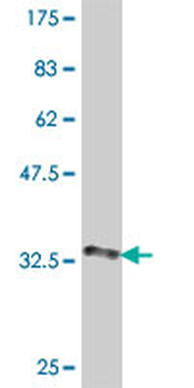 SLURP1 polyclonal antibody (A01)