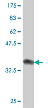 CHMP1B polyclonal antibody (A01)