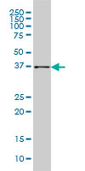 AKR1B10 monoclonal antibody (M01), clone 1A6