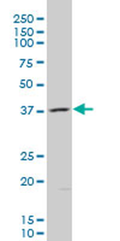 AKR1B10 polyclonal antibody (A01)