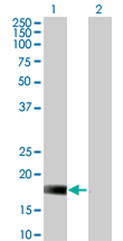 DUSP22 monoclonal antibody (M01), clone 3D3
