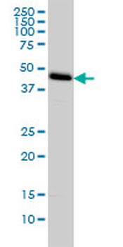C1GALT1 monoclonal antibody (M01), clone 1F1