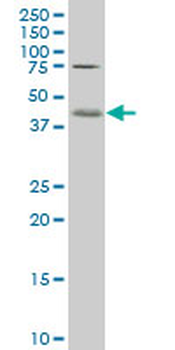 C1GALT1 polyclonal antibody (A01)