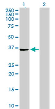 AGPAT4 purified MaxPab mouse polyclonal antibody (B01P)