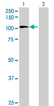MDM1 MaxPab mouse polyclonal antibody (B01)