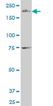 FMN2 polyclonal antibody (A01)