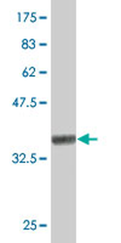 JPH1 polyclonal antibody (A01)