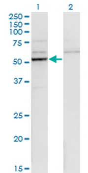 CYP26B1 monoclonal antibody (M01), clone 1H6