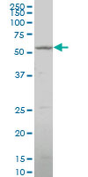 CYP26B1 polyclonal antibody (A01)