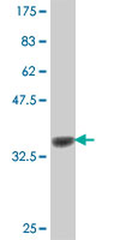 PCDHB10 polyclonal antibody (A01)