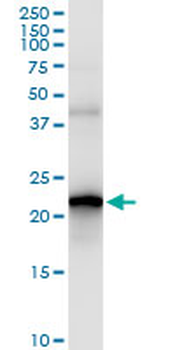 SELS MaxPab rabbit polyclonal antibody (D01)