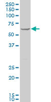 DCP1A polyclonal antibody (A01)