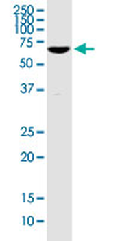 CHFR monoclonal antibody (M01), clone 1H3-A12