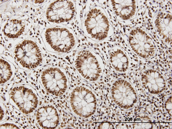CDKN2AIP purified MaxPab mouse polyclonal antibody (B01P)