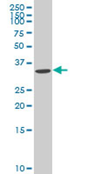 ABHD10 polyclonal antibody (A01)