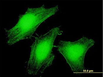 LARP6 purified MaxPab mouse polyclonal antibody (B01P)