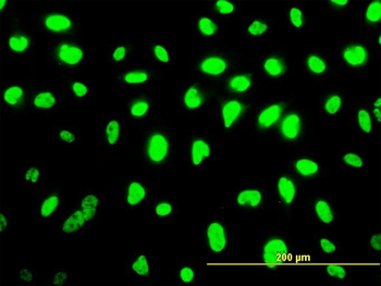 SMU1 monoclonal antibody (M01), clone 2B12-2F2