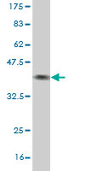 BBS7 monoclonal antibody (M01), clone 2H6