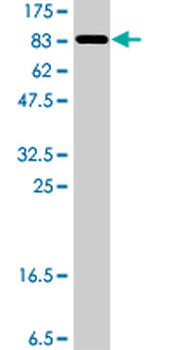CEP55 polyclonal antibody (A01)