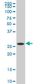 PNPO polyclonal antibody (A01)
