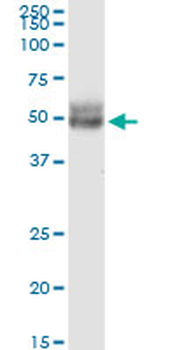 CCDC99 monoclonal antibody (M01), clone 2F4