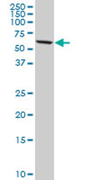 DDX56 monoclonal antibody (M03), clone 6B9