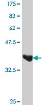 UGT1A9 polyclonal antibody (A01)