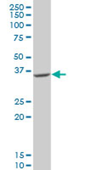 GDAP1 polyclonal antibody (A01)