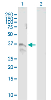 TM6SF2 purified MaxPab mouse polyclonal antibody (B01P)