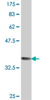 VPS29 polyclonal antibody (A01)