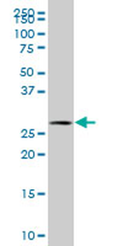 SCLY polyclonal antibody (A01)