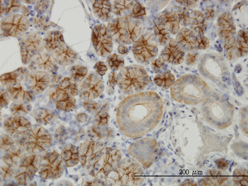 RHCG monoclonal antibody (M06), clone 5A4