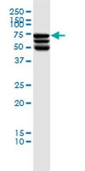 DDX41 monoclonal antibody (M01), clone 2F4