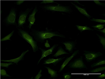 PIPOX monoclonal antibody (M10), clone 3D1