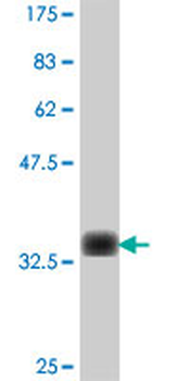 MARCH2 polyclonal antibody (A01)