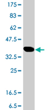 HERC5 polyclonal antibody (A01)