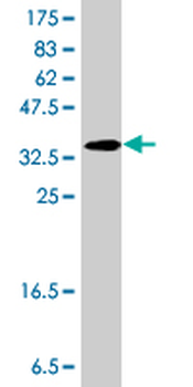 AADAT polyclonal antibody (A01)