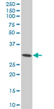 HSD17B12 polyclonal antibody (A01)