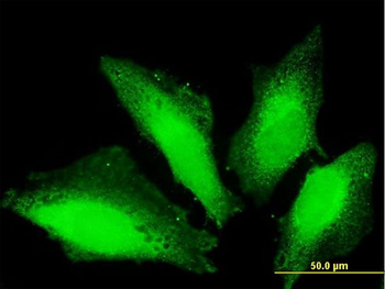 TTC15 purified MaxPab mouse polyclonal antibody (B01P)