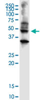 ABHD5 monoclonal antibody (M01), clone 1F3
