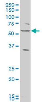 LAP3 polyclonal antibody (A01)