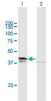 DHH purified MaxPab mouse polyclonal antibody (B01P)