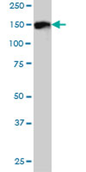 DDEF1 monoclonal antibody (M01), clone 2G7