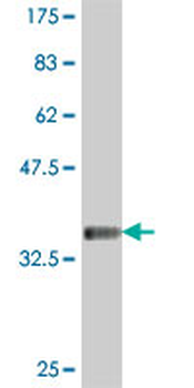 PLA2G3 polyclonal antibody (A01)