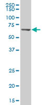 ERO1L polyclonal antibody (A01)