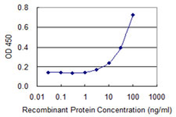 BAZ2B monoclonal antibody (M07), clone 2D10