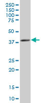 PSAT1 polyclonal antibody (A01)